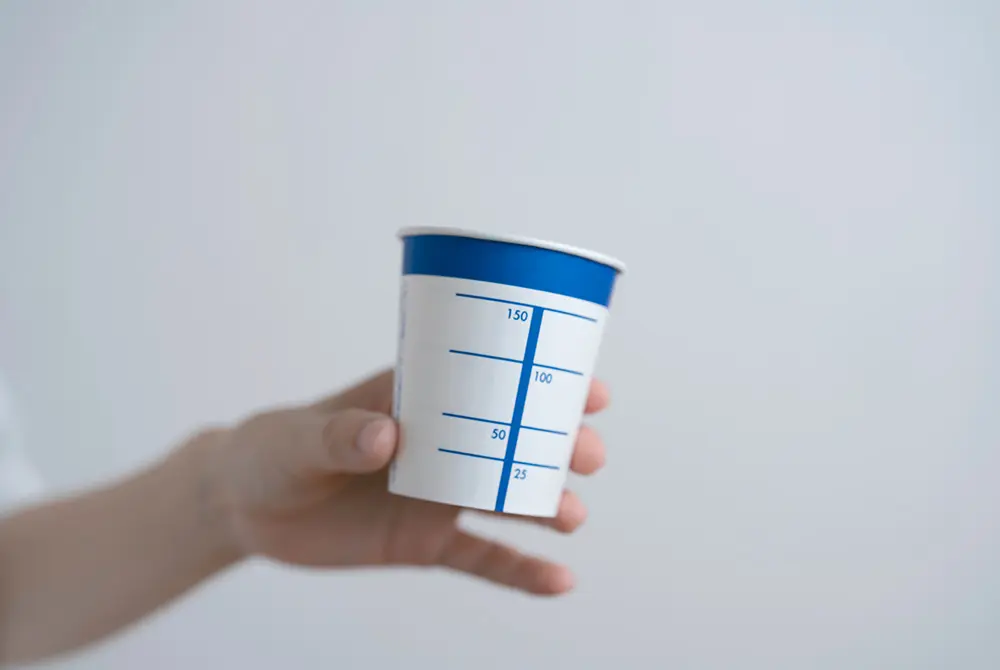 目盛り付きの尿検査用カップを手に持っている様子。