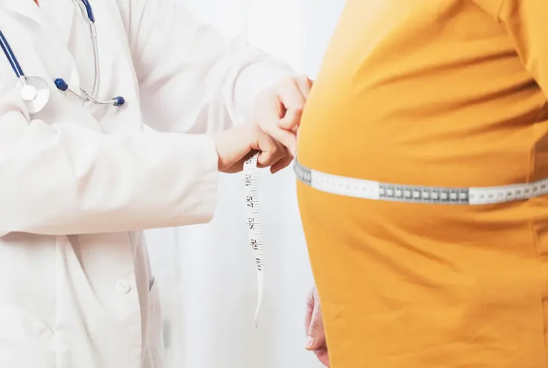 医師がメジャーで腹囲を測定している様子