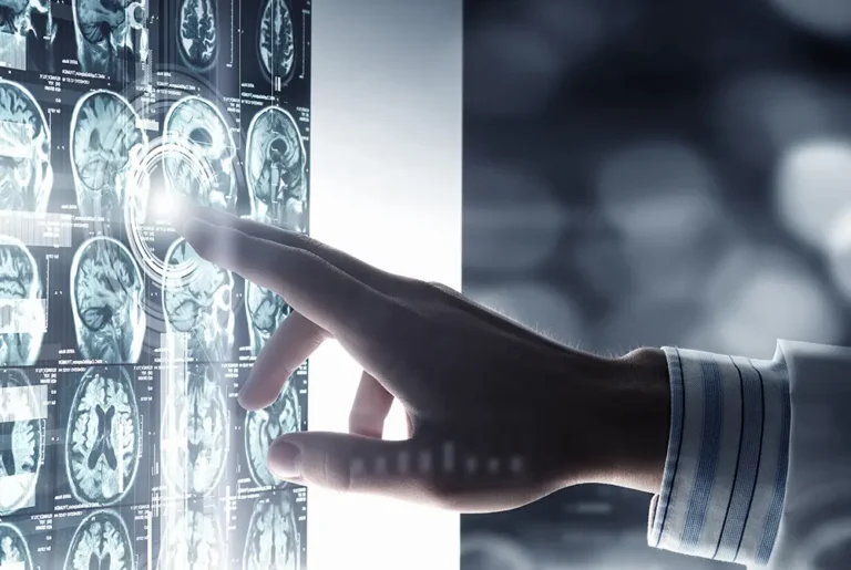 脳の画像を確認する医師の手元