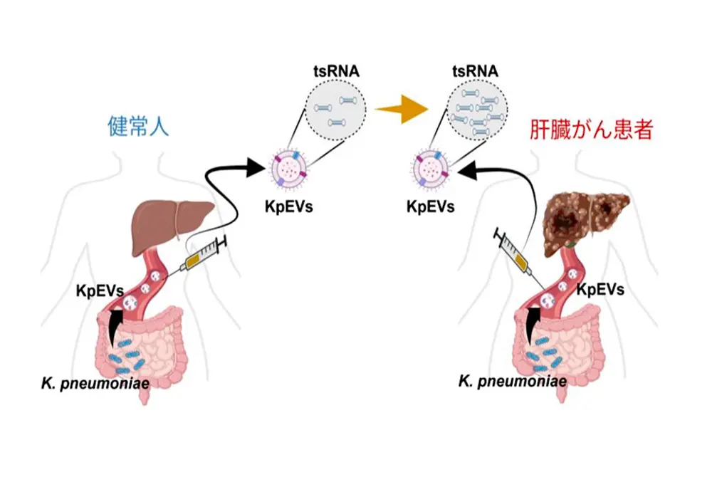 腸内細菌由来のKpEVsとtsRNAが肝臓がんと関連する仕組みを示した図
