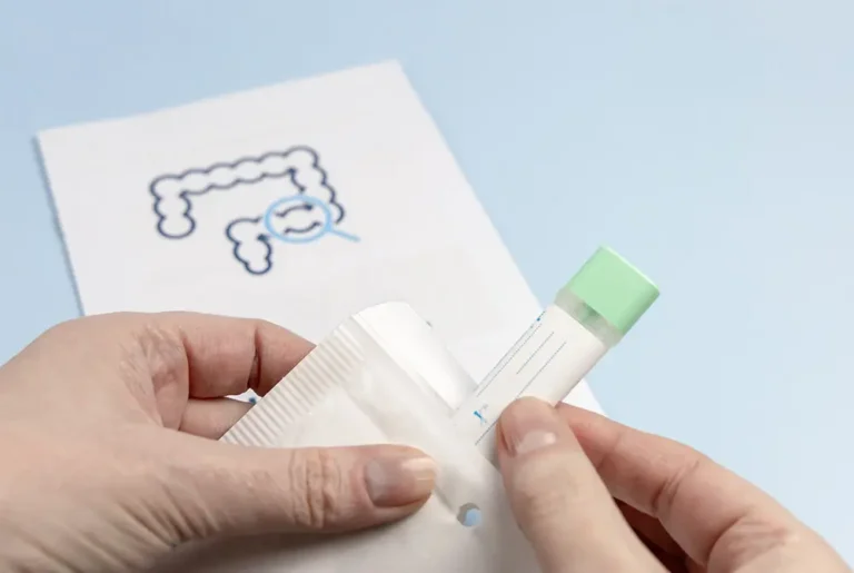 便検査用の採取容器を手に持ち袋から取り出す様子