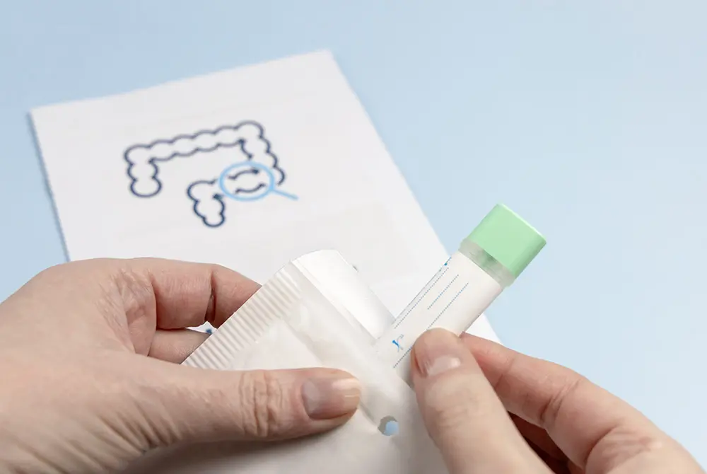 便検査用の採取容器を手に持ち袋から取り出す様子