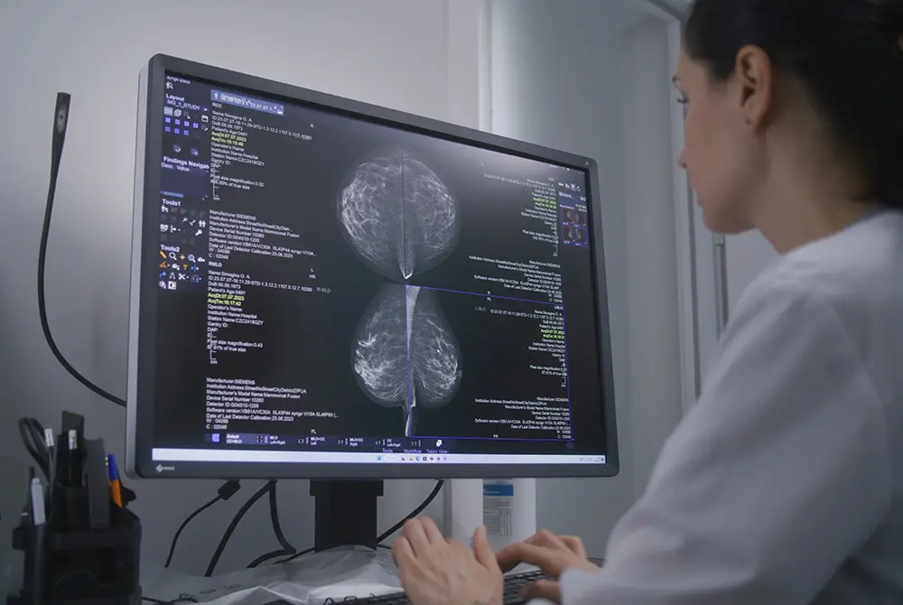 医師が乳房の画像データをパソコン画面で確認している様子