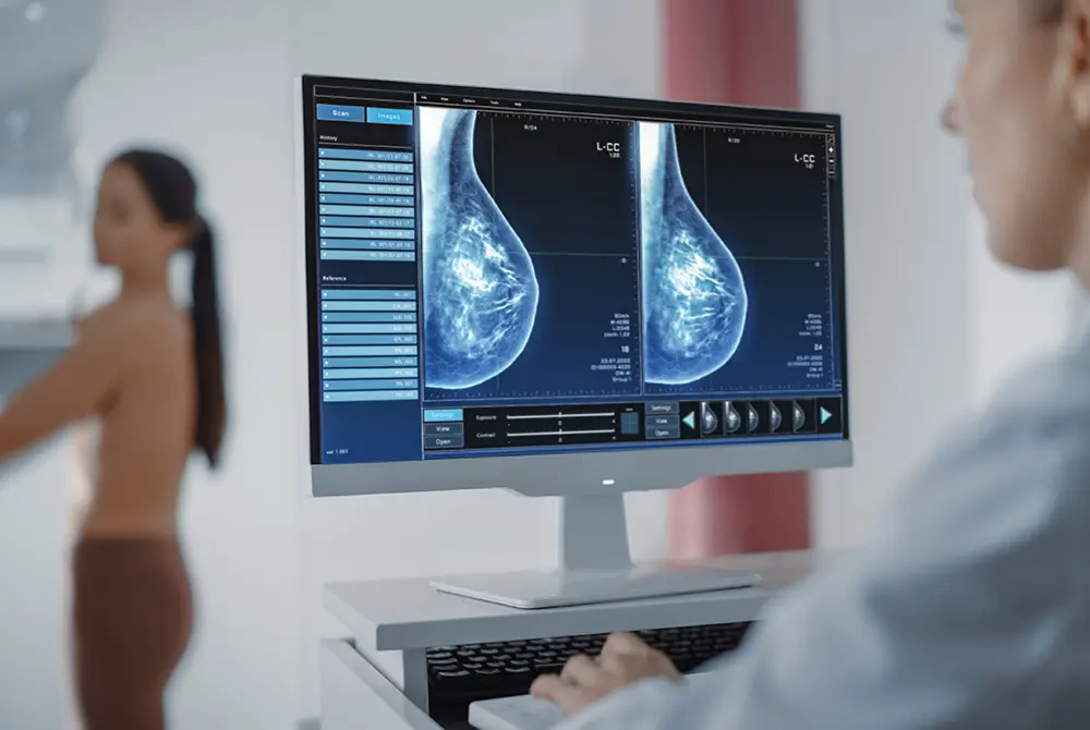 モニターに表示されたマンモグラフィ画像を医療者が確認している様子