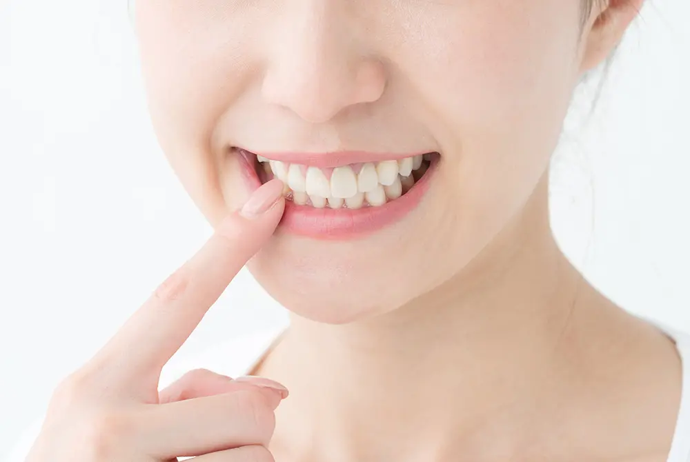 女性が指で歯ぐきを触れて状態を気にしている様子