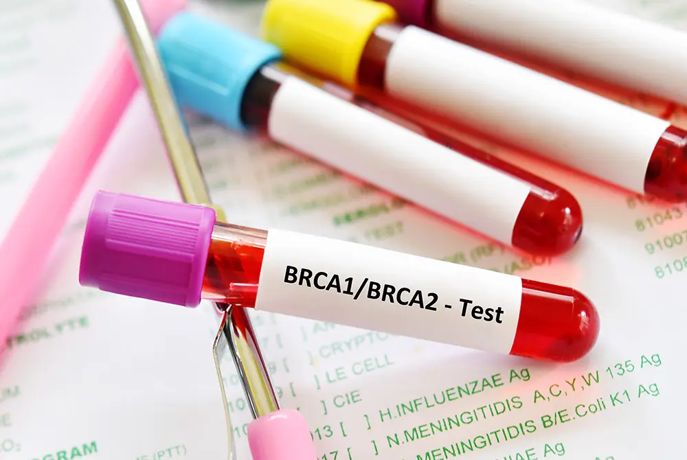 BRCA1およびBRCA2遺伝子検査用の血液サンプルが入った試験管