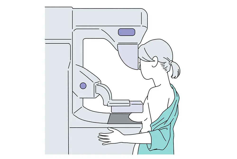 マンモグラフィ検査装置に乳房を挟み、検査を受けている女性の横向きのイラスト。