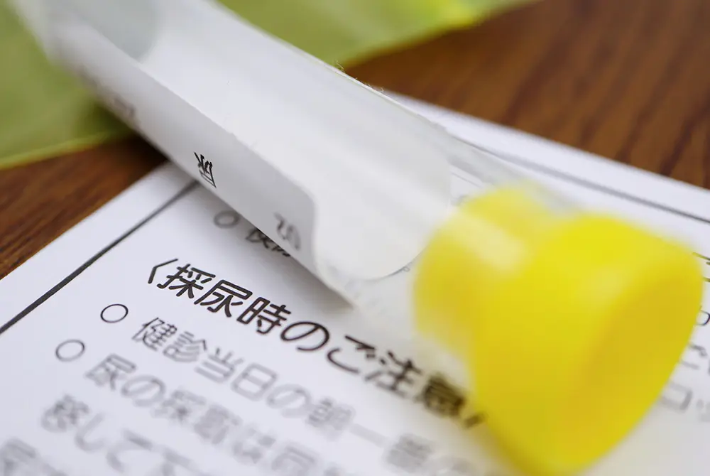 採尿時の注意事項が書かれた書類の上に、尿検査用の採尿容器が置かれている様子。