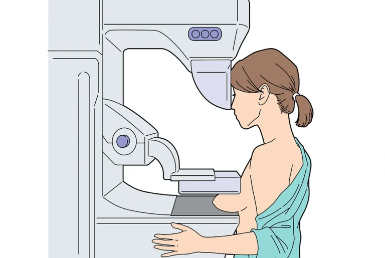 マンモグラフィ検査装置で乳房の撮影を受ける女性のイラスト。