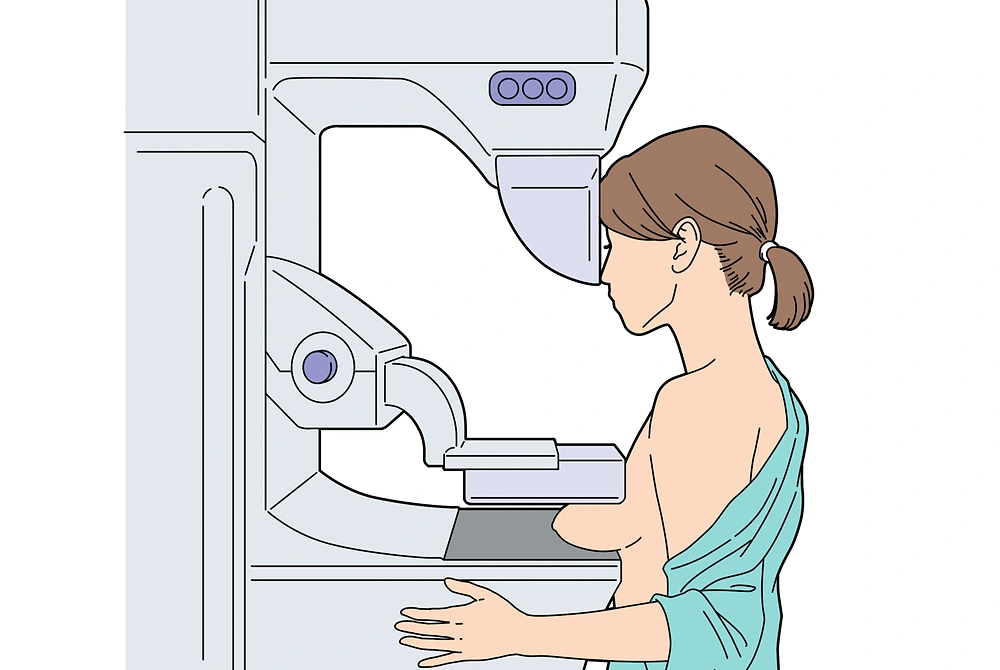 マンモグラフィ検査装置で乳房の撮影を受ける女性のイラスト。