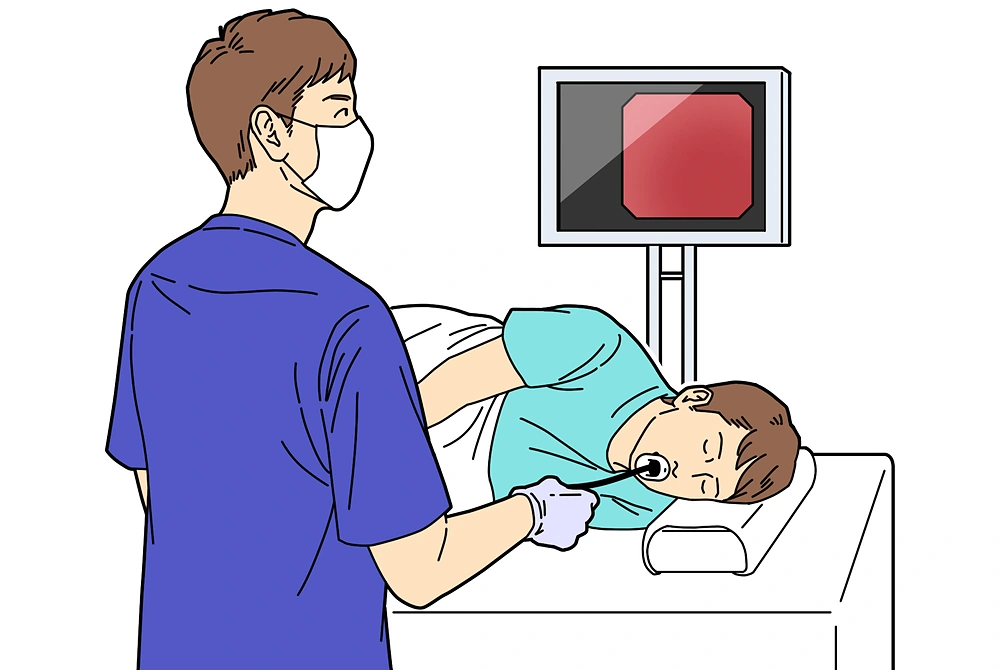 医療スタッフが、横向きに寝た患者に内視鏡検査を行っているイラスト。