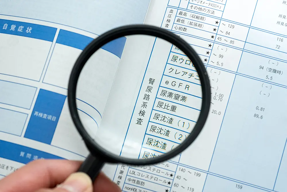 健康診断の検査結果表の尿検査項目を、虫眼鏡で確認している様子。