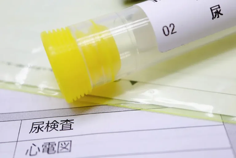 尿検査の書類の上に置かれた採尿容器。
