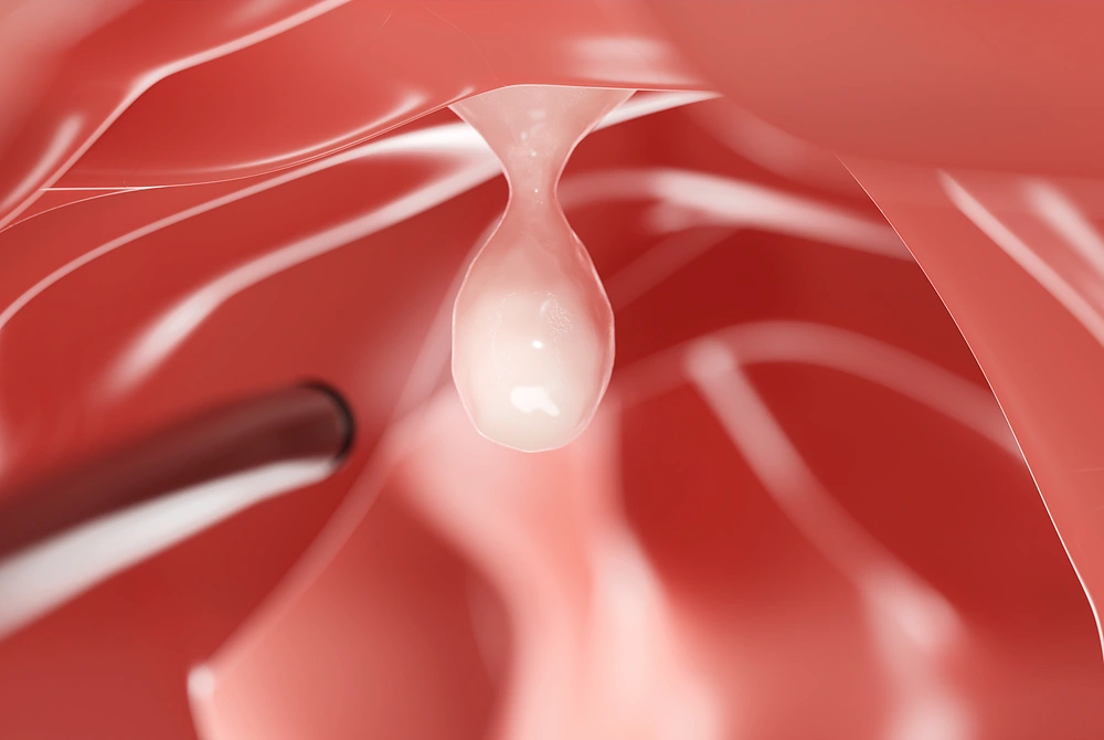 大腸内視鏡で、大腸内のポリープのような隆起を観察している図。