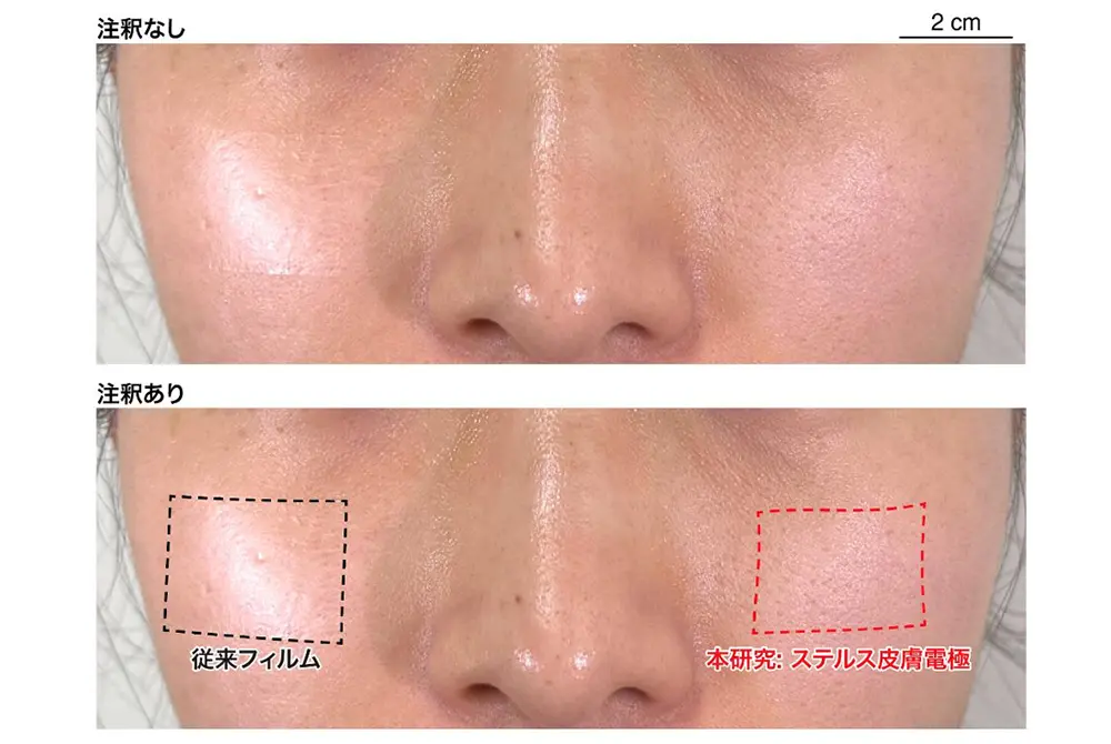 頬に従来フィルムとステルス皮膚電極を貼った状態を、注釈なしと注釈ありで比較した写真。
