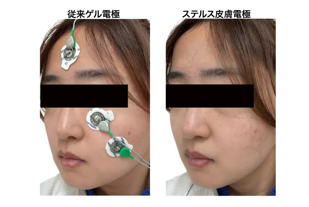 顔に従来ゲル電極を貼った状態と、目立ちにくいステルス皮膚電極を貼った状態を比較した写真。