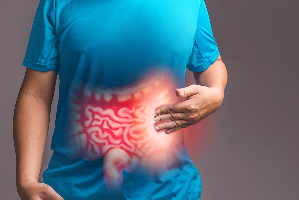 腹部に手を当てた人物と、腸の炎症や異常を示すイメージ図。