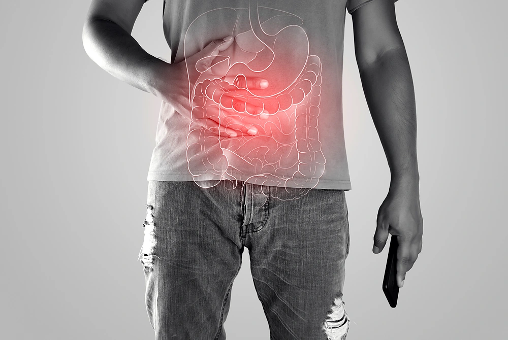 腹部に手を当てる人物と、胃腸の模式図が重ねられた医療イメージ。